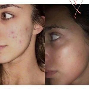 Teen sex hd stream Hot natural nude teen